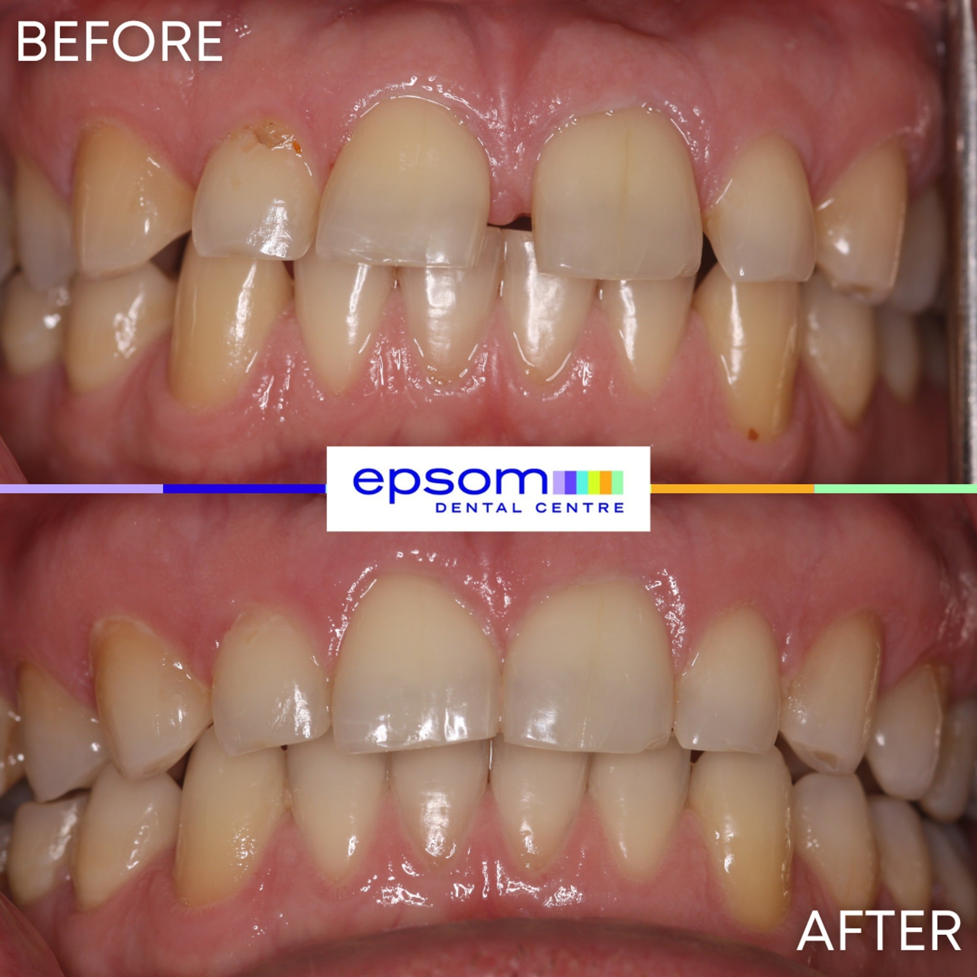 Before and after treatment
