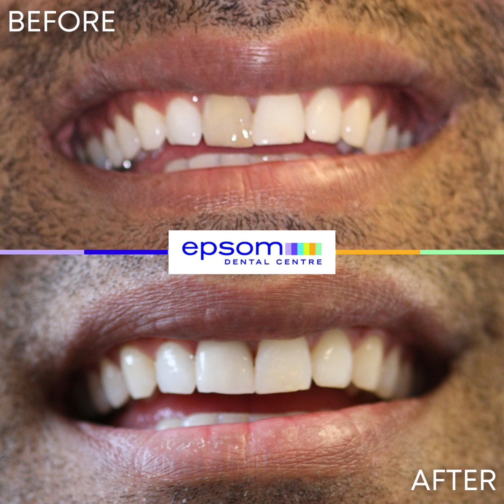 Before and after treatment