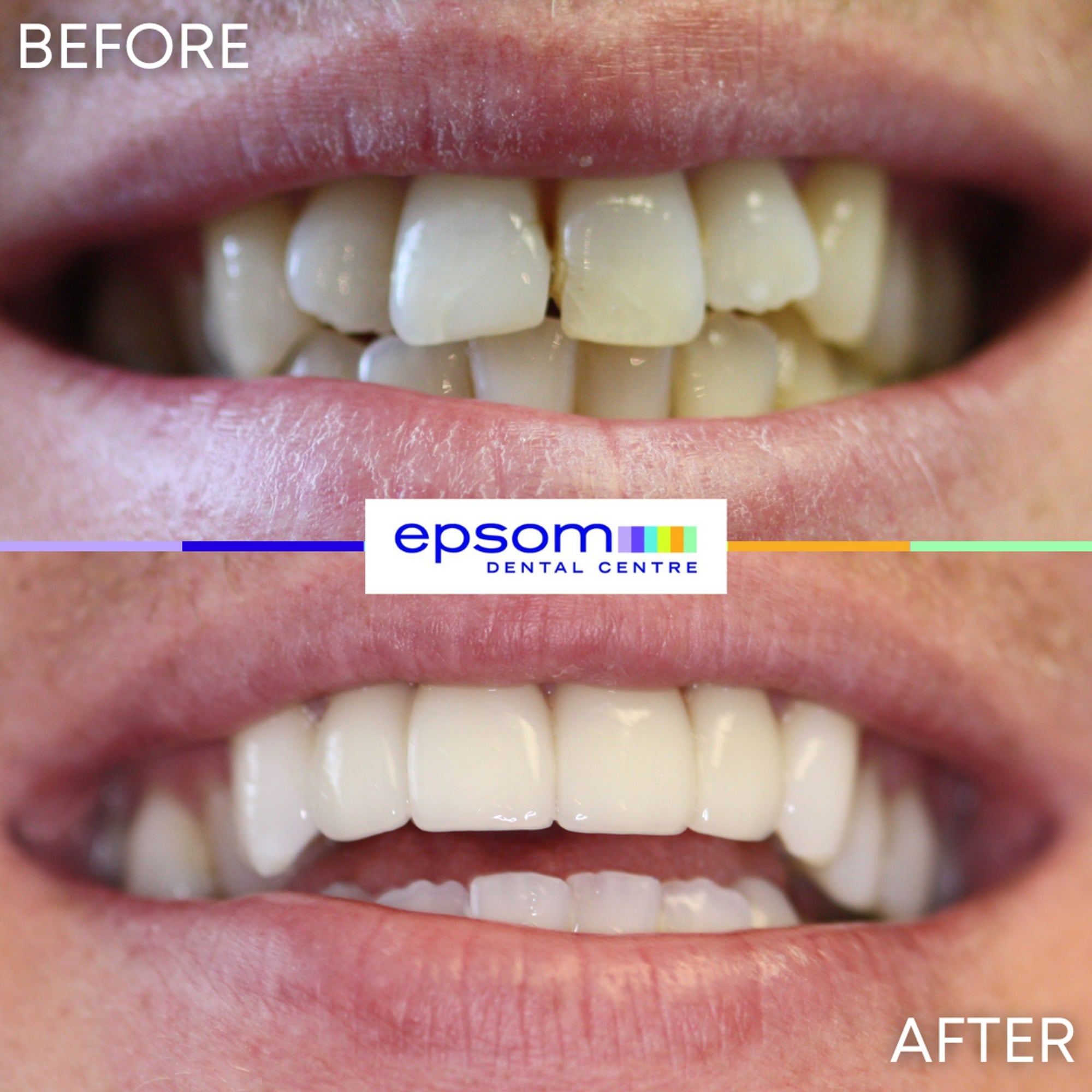 Before and after treatment