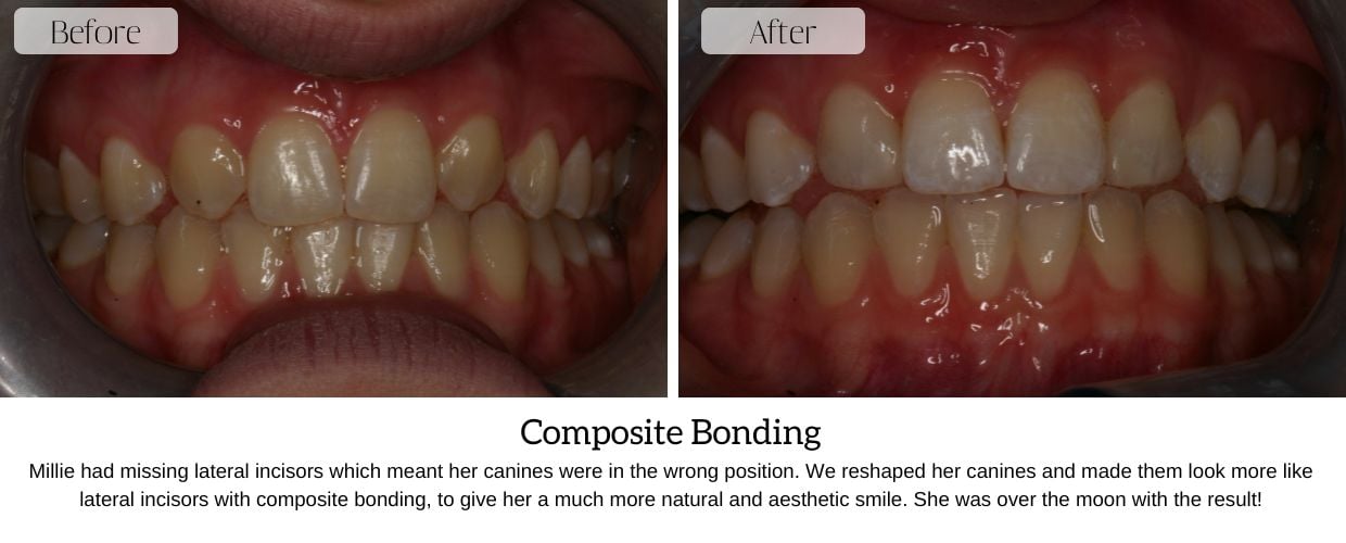 Before And After Smile Gallery at Epsom Dental Centre